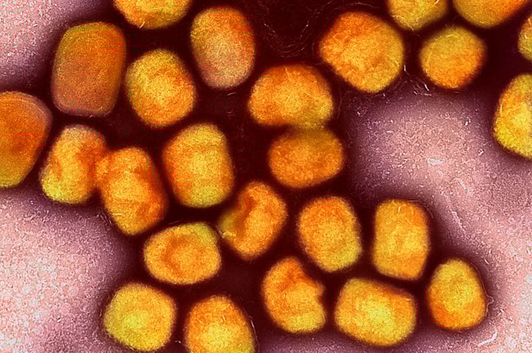 Monkeypox particles - make sure to credit to NIAID