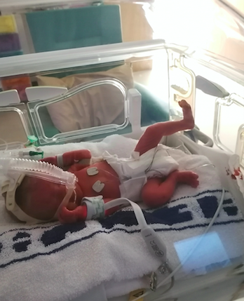 Little Jacob was born ten weeks premature, weighing a mere 3lb 13oz.