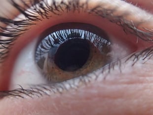 Brecon optician sounds warning as glaucoma referrals rise