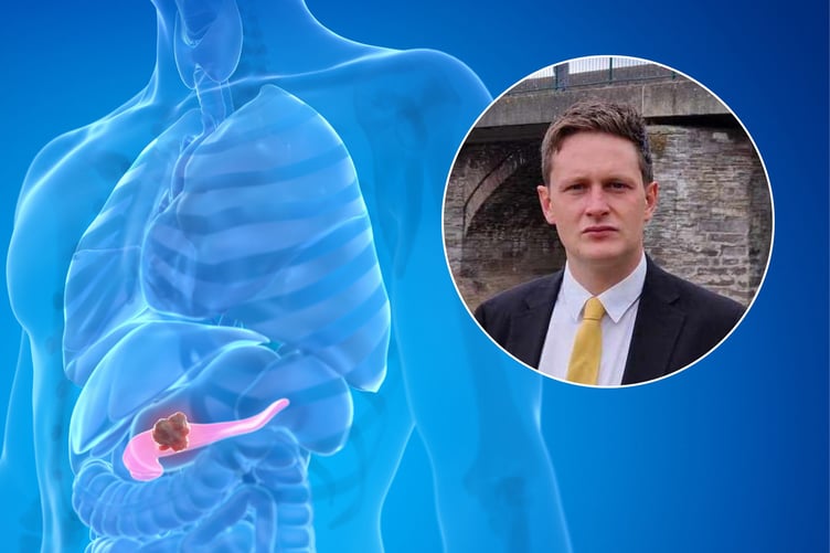 David Chadwick visited the Pancreatic Cancer UK stand at the Liberal Democrat party conference, highlighting the urgent need for increased support and research into the deadliest common cancer