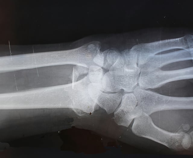 £1.7m boost for X-ray services in Powys