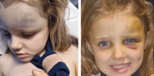 Family thanks emergency services after five-year-old’s scary fall