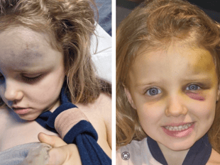 Family thanks emergency services after five-year-old’s scary fall