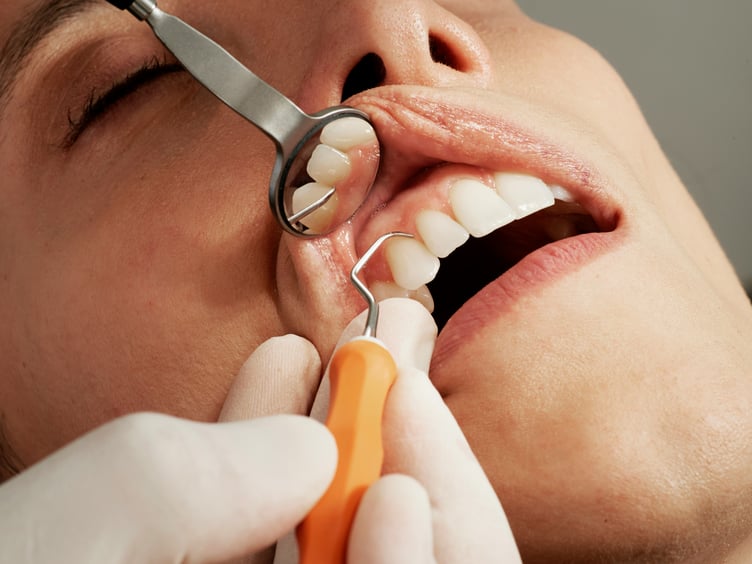 NHS Wales dentists will no longer see patients routinely twice a year