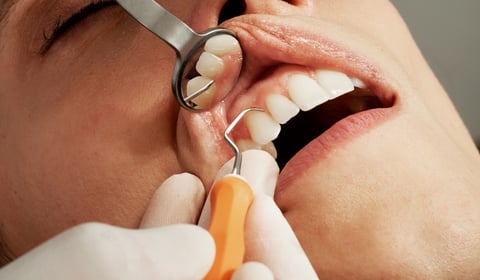 Welsh Lib Dems Slam Labour’s Dental Crisis