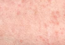 Visiting restricted at Powys hospital after scabies cases